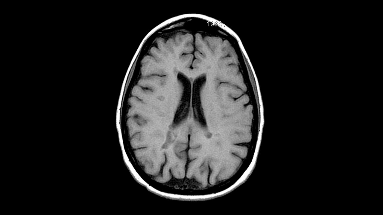 Types of MRI scans