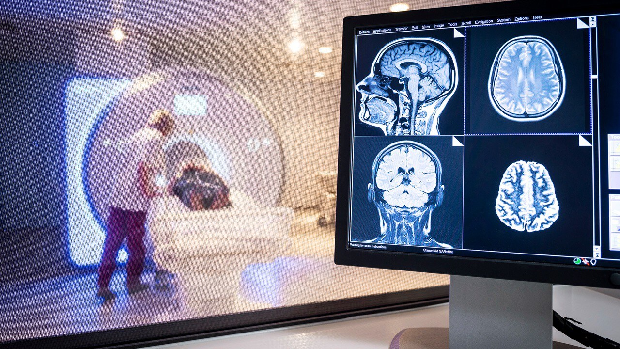 MRI image planes